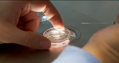 In vitro fertilization 