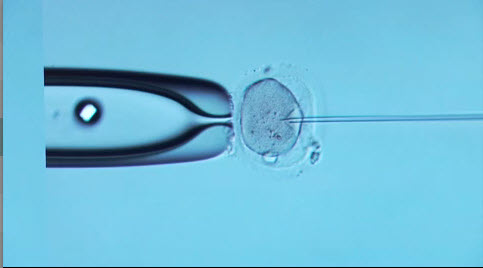 IVF process 